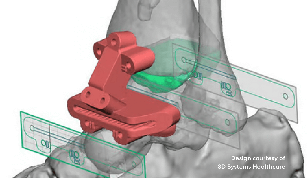img-Unconstrained_modeling